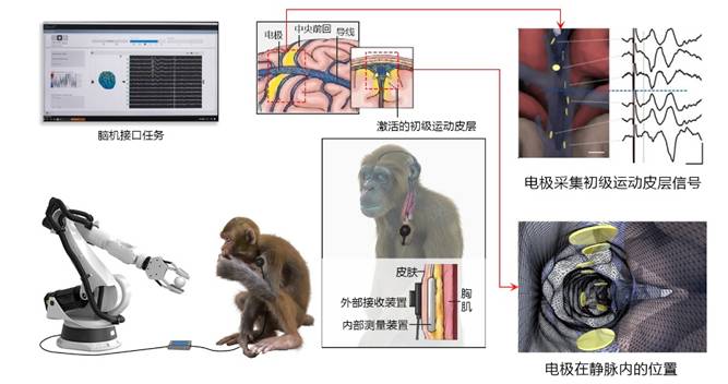 介入式脑机接口